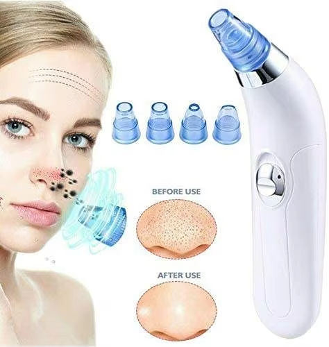 Blackhead Remover Vacuum – Rechargeable Pore Cleaner for All Skin Types